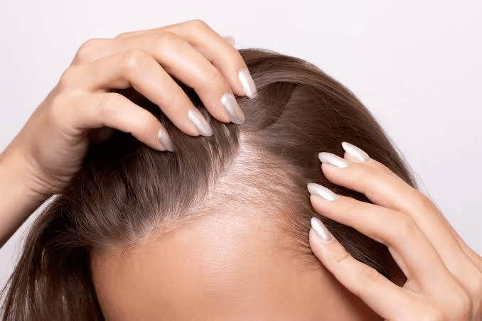 Hair Thinning Treatment