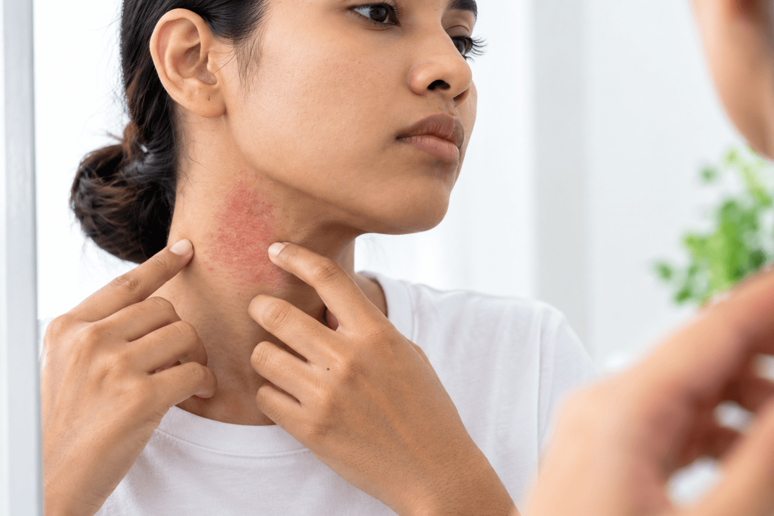 Skin Infection Treatment
