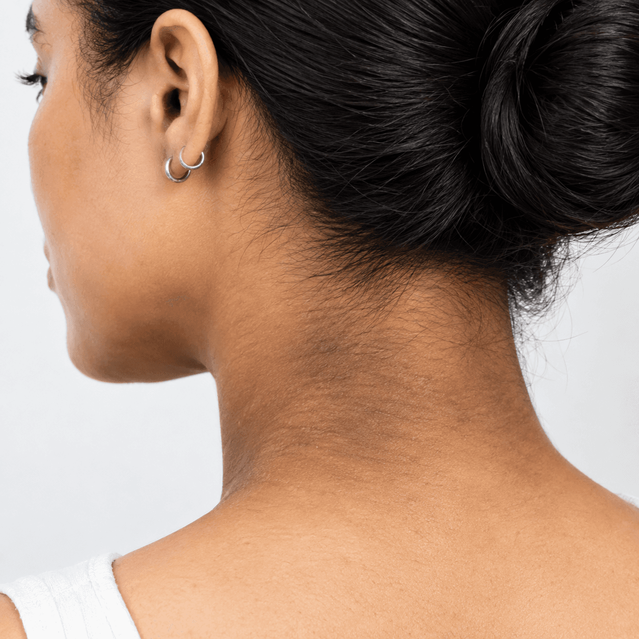 Dark Neck Treatment